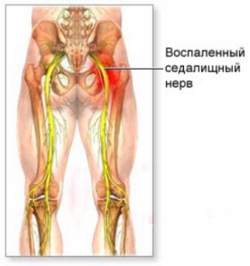 и